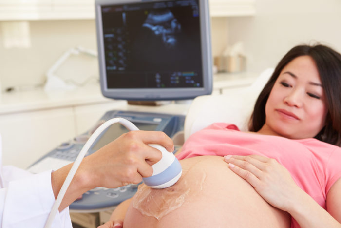 妊娠の超音波