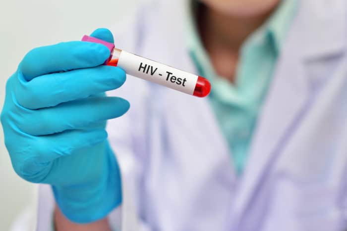 HIV血液検査